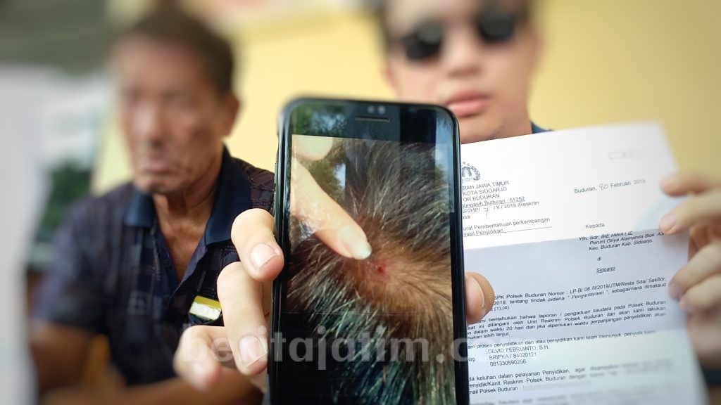 Kepala Dipukul Kayu, Bie Laporkan Tetangga