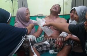 Kebakaran Pom Mini Milik Anggota DPRD Sumenep: Satu Karyawan Alami Luka Bakar