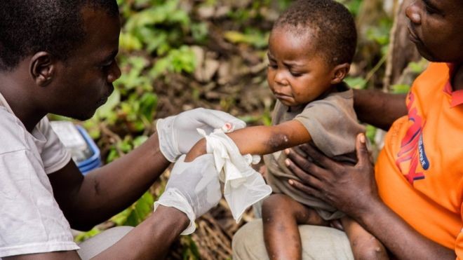 Awas Cacar monyet, Virus Asal Afrika