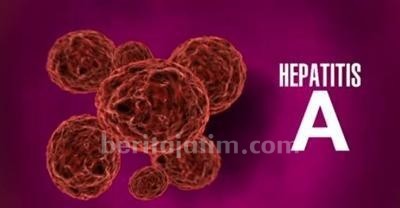 Ramai Kabar Hepatitis Akut, Begini Imbauan Dinkes Magetan
