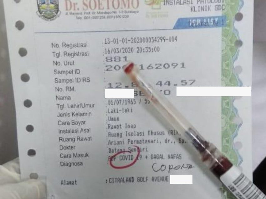 Bukan Positif Corona, Tetapi PDP di RSUD Dr Soetomo
