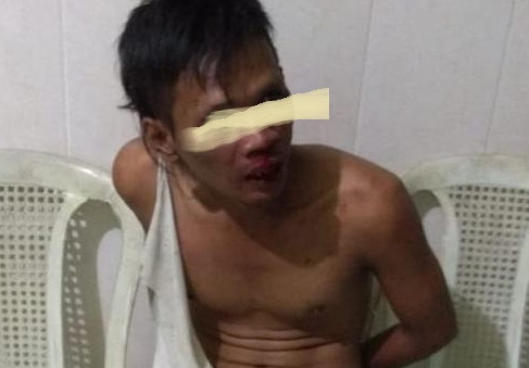 Seorang Pria Tanpa Identitas Babak Belur Dihajar Warga