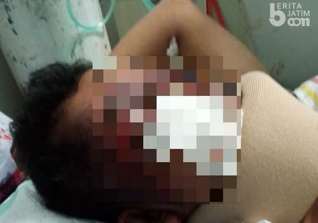 Warga Sukodono Penuh Luka Dibuang ke Semak-semak, Diduga Korban Begal