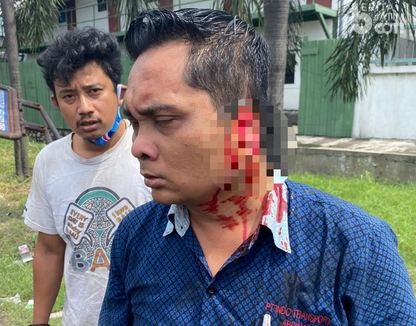 Emosi, Rizal Gigit Telinga Kondektur Bus Mandala, Digigit Sampai Putus