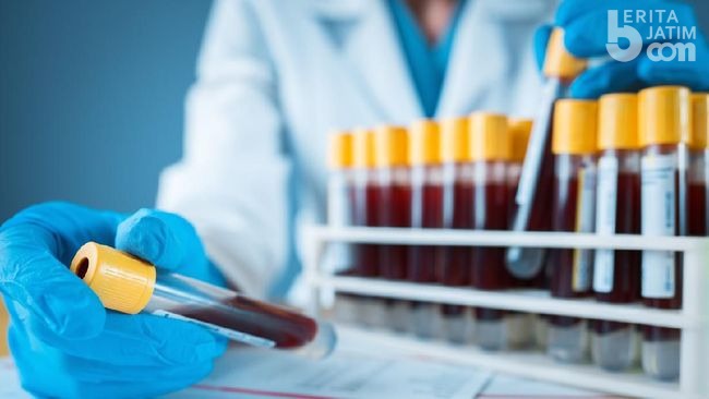 Reagen Swab PCR Tes Milik Pemkot Surabaya Mulai Menipis