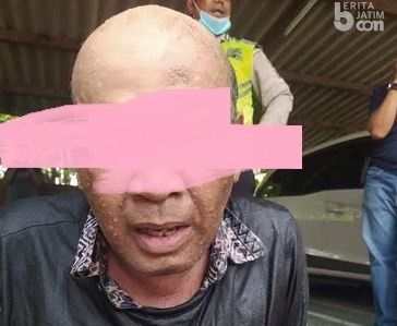 Pengendara Motor Disiram Bensin lalu Dibakar