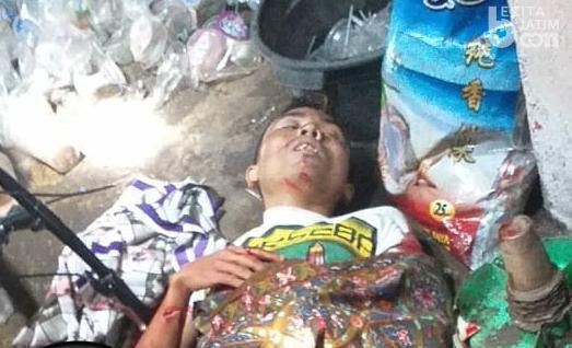 Lelaki Ini Jadi Korban Penusukan di Semampir Surabaya