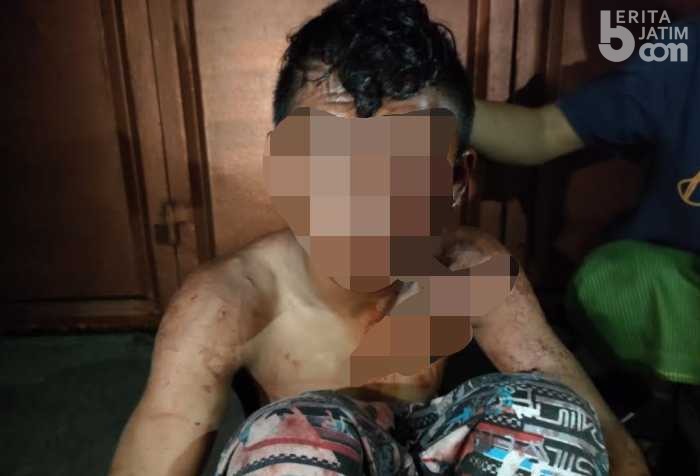 Dihajar Warga Demak Surabaya Usai Curi Motor, Pemuda Ini Babak Belur ilustrasi babak belur