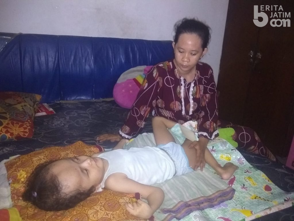 Balita Penderita Hydrocephalus di Candi Sidoarjo Butuh Bantuan