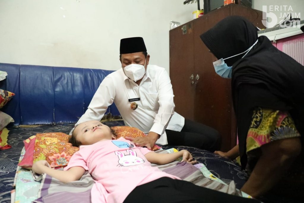 Pemkab Sidoarjo Beri Bantuan pada Anak Penderita Hidrosefalus
