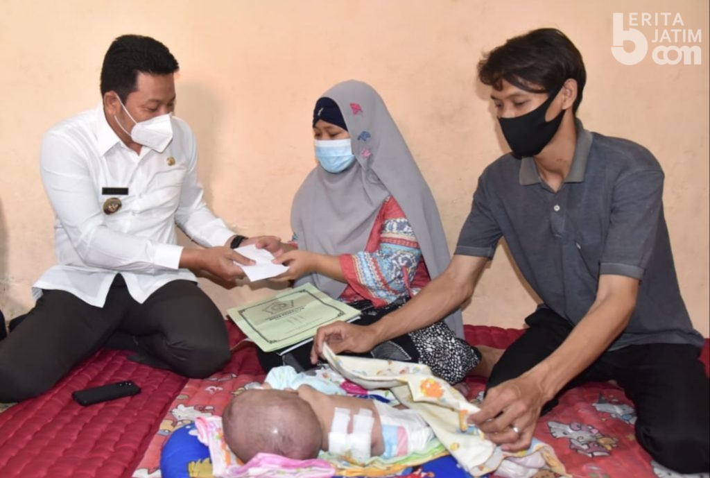 Pemkab Sidoarjo Fasilitasi Pengobatan Bayi Nayla Penderita Hidrosefalus dan Spina Bifida