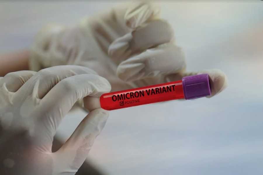 Deteksi Varian Omicron, Sampel 4 Warga Gresik Dikirim ke ITD Unair
