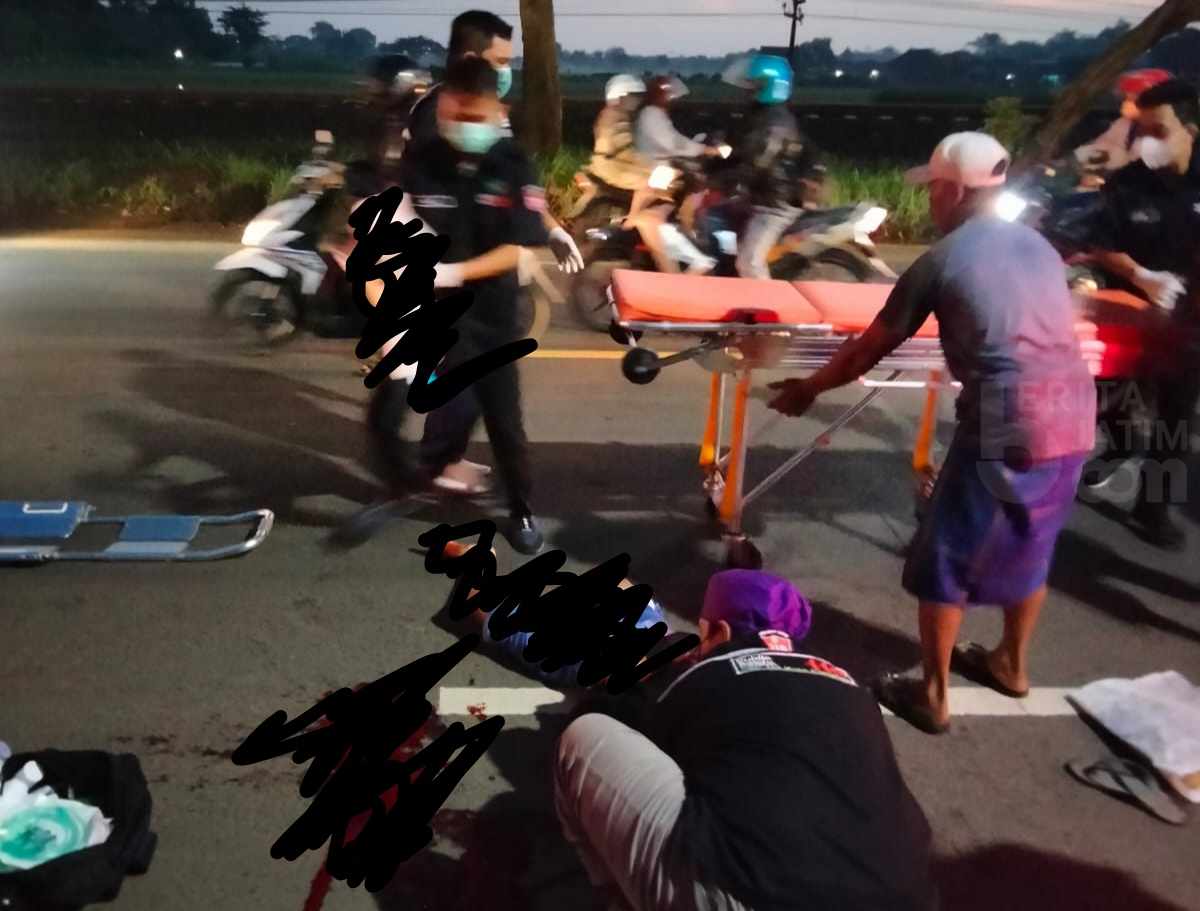 Kaki Putus Pengendara Motor Berhasil Selamat Akibat Kecelakaan Di Pasuruan