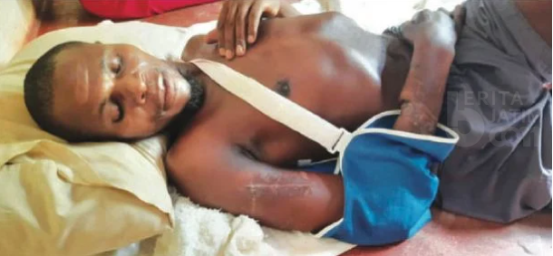 Ajaib, Pria Ini Mampu Bertahan dari Serangan Tiga Buaya