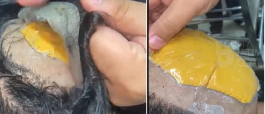 Petugas Curiga Pada Wig Penumpang Pesawat, Ternyata Isinya Emas