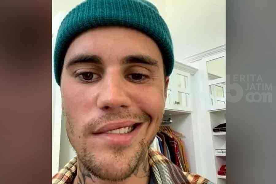 Justin Bieber Dinyatakan Alami Ramsay Hunt Syndrome, Pakar Sebut Berkaitan dengan Reaktivasi Virus