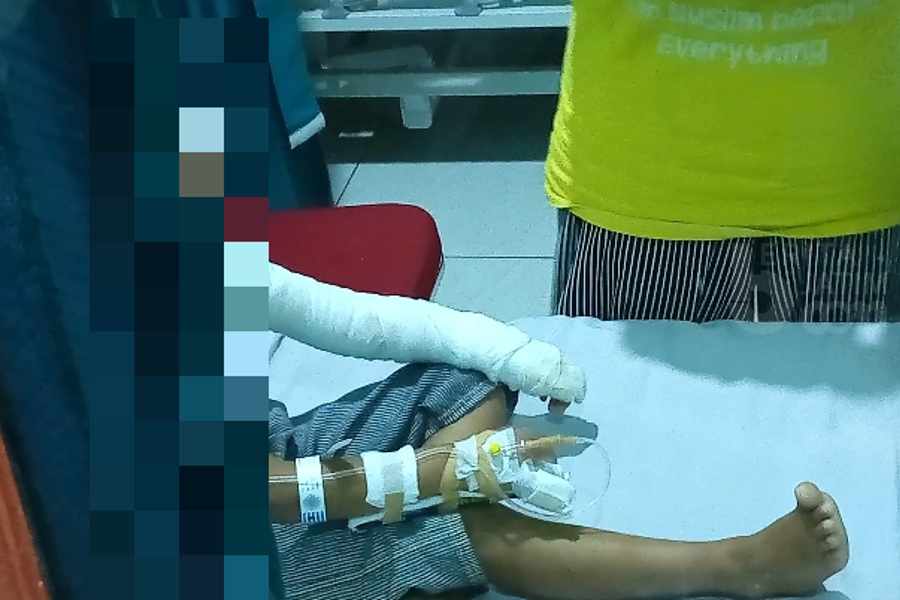 Jajan Makanan Berasap, Wajah dan Bocah di Ponorogo Terbakar
