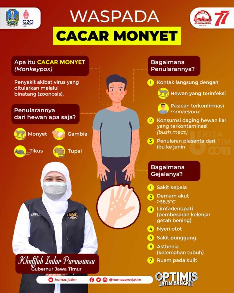 Pastikan Jatim Nol Kasus Cacar Monyet, Khofifah Imbau Warga Tenang