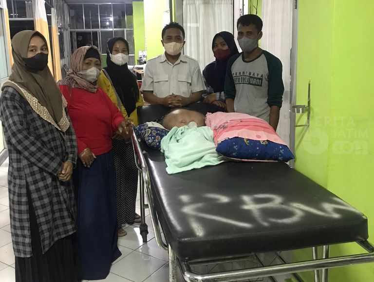 Terlambat ke RS, Balita Penderita Hidrosefalus di Jember Rentan Dioperasi