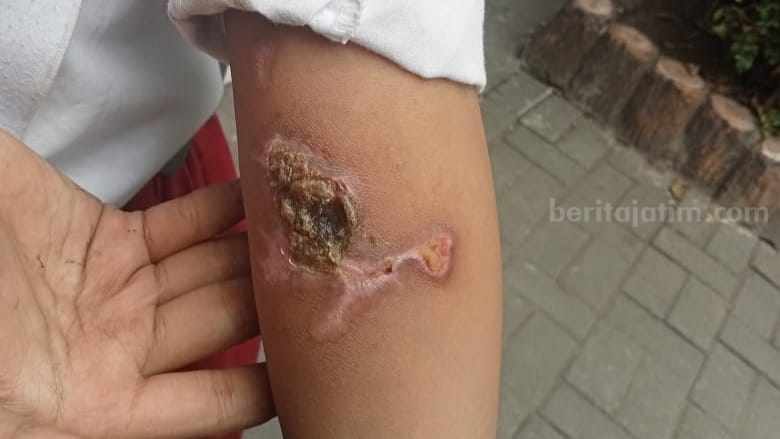Anak Dibawah Umur di Gresik Alami Penyiksaan Selama Enam Tahun