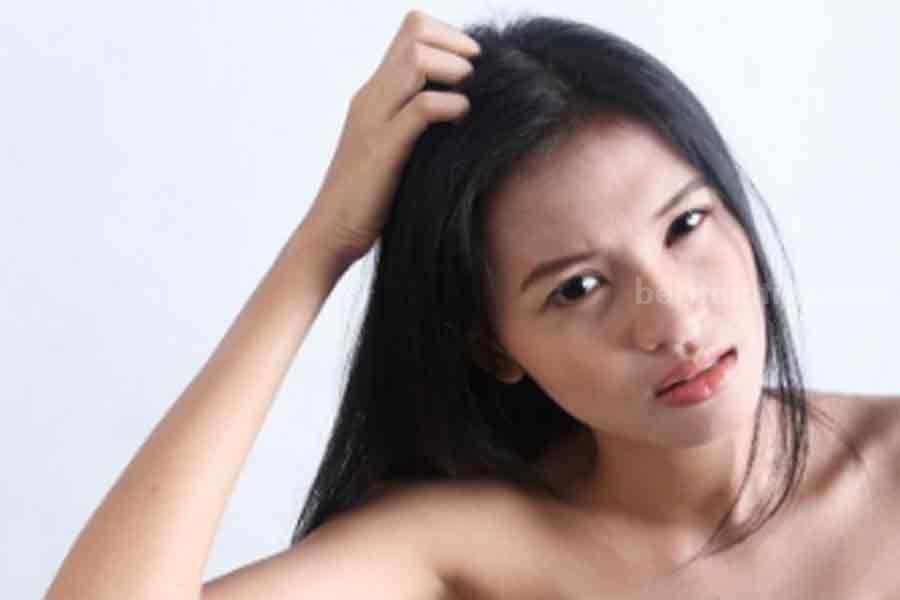 Ilustrasi rambut yang ditinggali kutu. 