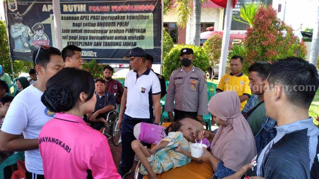 Aisyah Ade Rahma, Bocah Pengidap Penyakit Hidrosefalus di Probolinggo Butuh Bantuan
