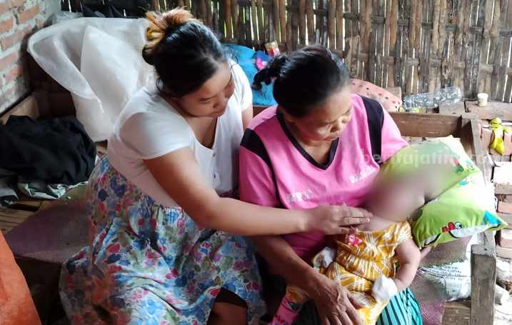 Kasihan, Bayi Usia 3 Bulan di Ponorogo Tanpa Tempurung Kepala