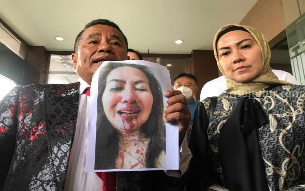 Venna Melinda Akui Sangat Bucin Dengan Ferry Irawan