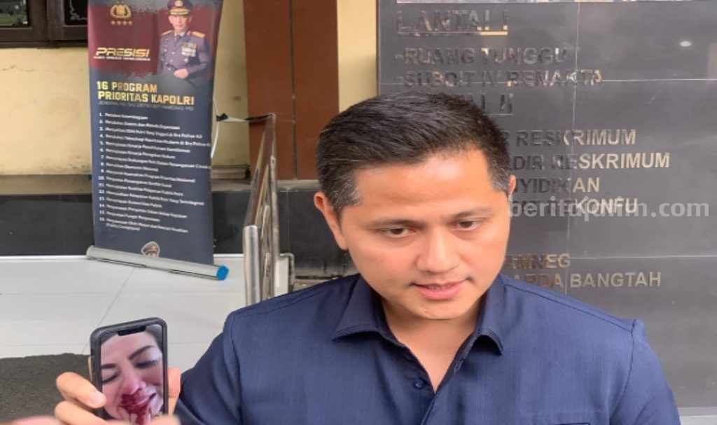 Venna Melinda Mengaku Trauma Akibat KDRT Ferry Irawan Reza Mahastra