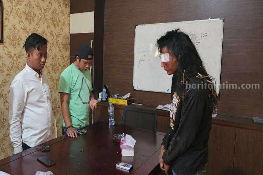 Pengedar Narkoba Lari dan Terjun ke Sungai, Ternyata Sungainya Kering, Kepalanya Terluka Pelaku Suyuti (21) saat diamankan di Polres Pasuruan.