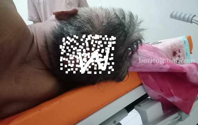 Korban menderita luka bacok di bagian kepala menjalani perawatan di RSNU Jombang