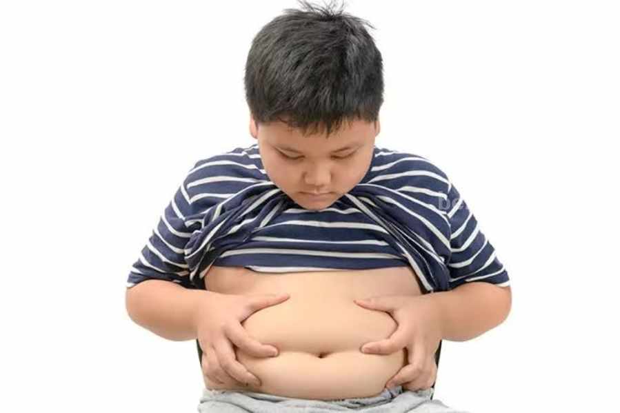 obesitas