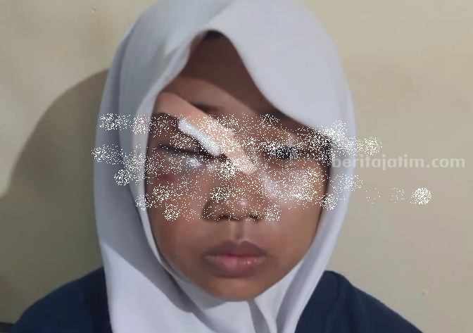 Korban Siswi SMK di Pasuruan diduga jadi korban begal dalam angkutan umum, Jumat (25/8/2023).