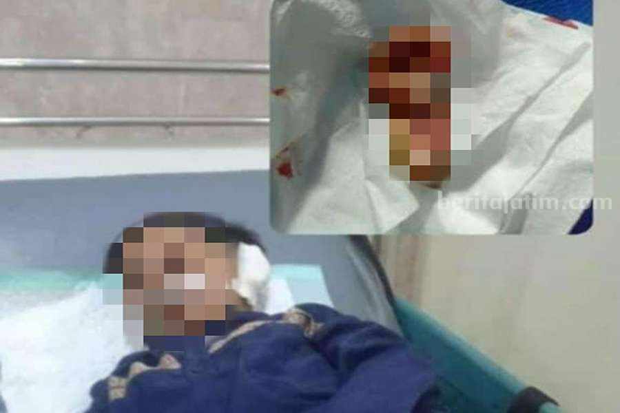 Kondisi korban saat dilarikan ke Puskesmas.