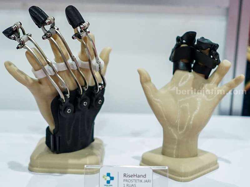 Komitmen Kembangkan Teknologi, ITS Surabaya Luncurkan 7 Alat Kesehatan RiseHand, alat bantu untuk menggantikan fungsi jari pada pasien amputasi jari yang diciptakan oleh ITS.