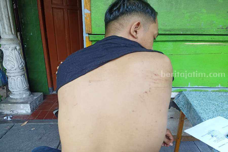 AJ menunjukan luka baret akibat disabet senjata tajam. Ia beruntung masih diberi keselamatan oleh tuhan atas peristiwa pengeroyokan yang dialami.