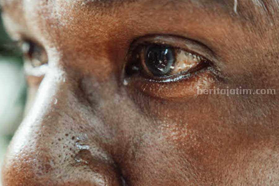 Ilustrasi mata berair. (Sumber foto: Pexels/Kindel Media)