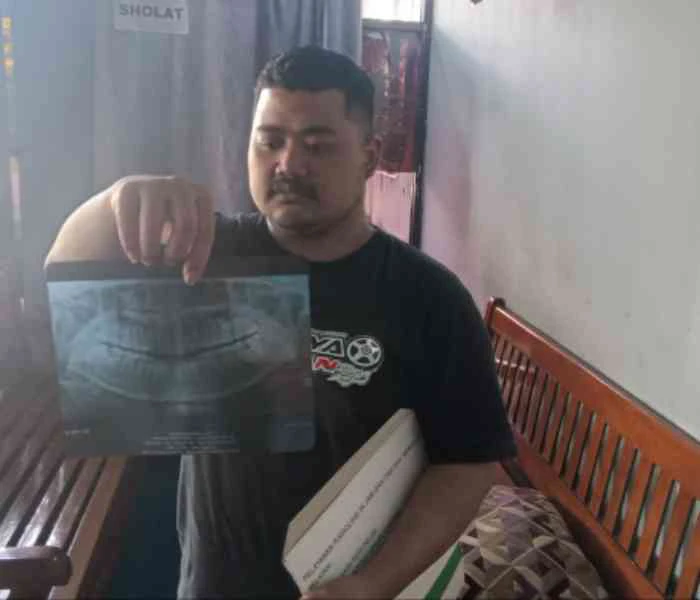 Ini Kronologi Wanita Ngawi yang Meninggal dengan Dugaan Infeksi Usai Cabut Gigi Foto Berita Jatim