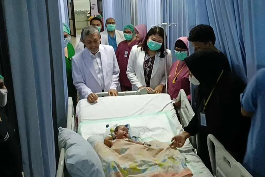 Bayi kembar siam di RSUD Dr Soetomo Surabaya.