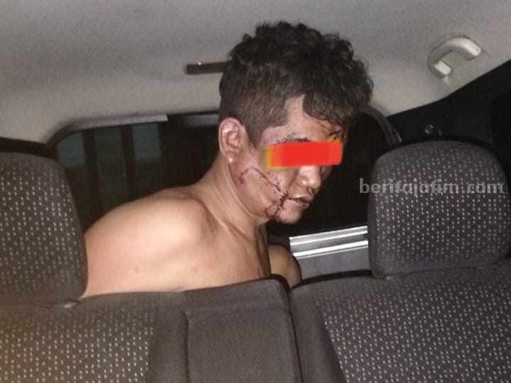 Pelaku pencurian Tiasan (44) usai babak belur dihakimi massa.