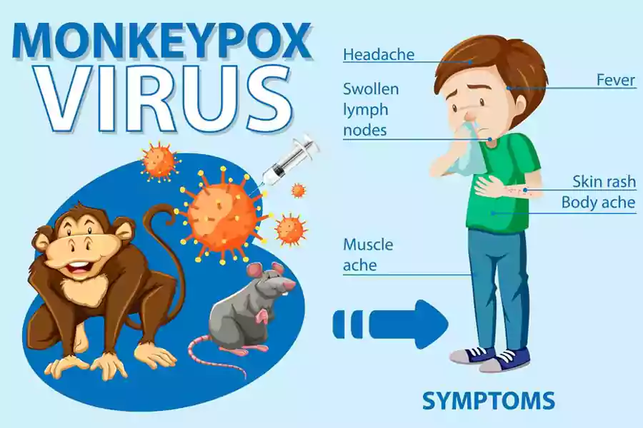 Ilustrasi virus cacar monyet yang menggejala.