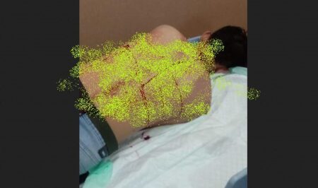 Penganiayaan Brutal di Banyuwangi, 3 Orang Berlumuran Darah Foto BeritaJatim.com