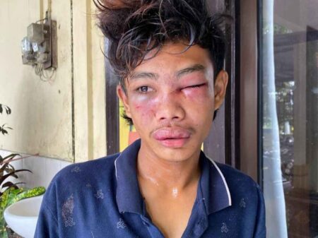 Jatuh Kecelakaan, Pencuri Motor di Gresik Langsung Dihajar Warga Foto BeritaJatim.com