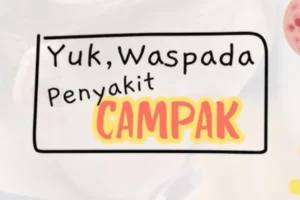 Dua Balita Terduga Campak di Pamekasan Meninggal Dunia Foto BeritaJatim.com