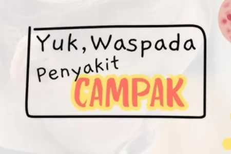 Dua Balita Terduga Campak di Pamekasan Meninggal Dunia Foto BeritaJatim.com